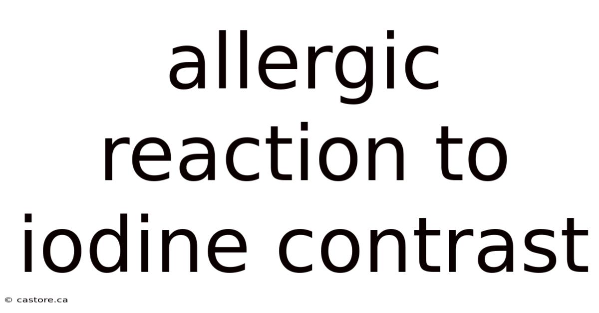 Allergic Reaction To Iodine Contrast
