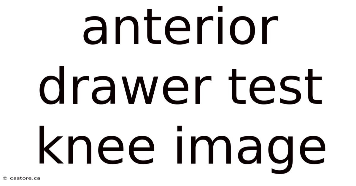 Anterior Drawer Test Knee Image