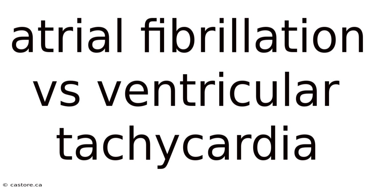 Atrial Fibrillation Vs Ventricular Tachycardia