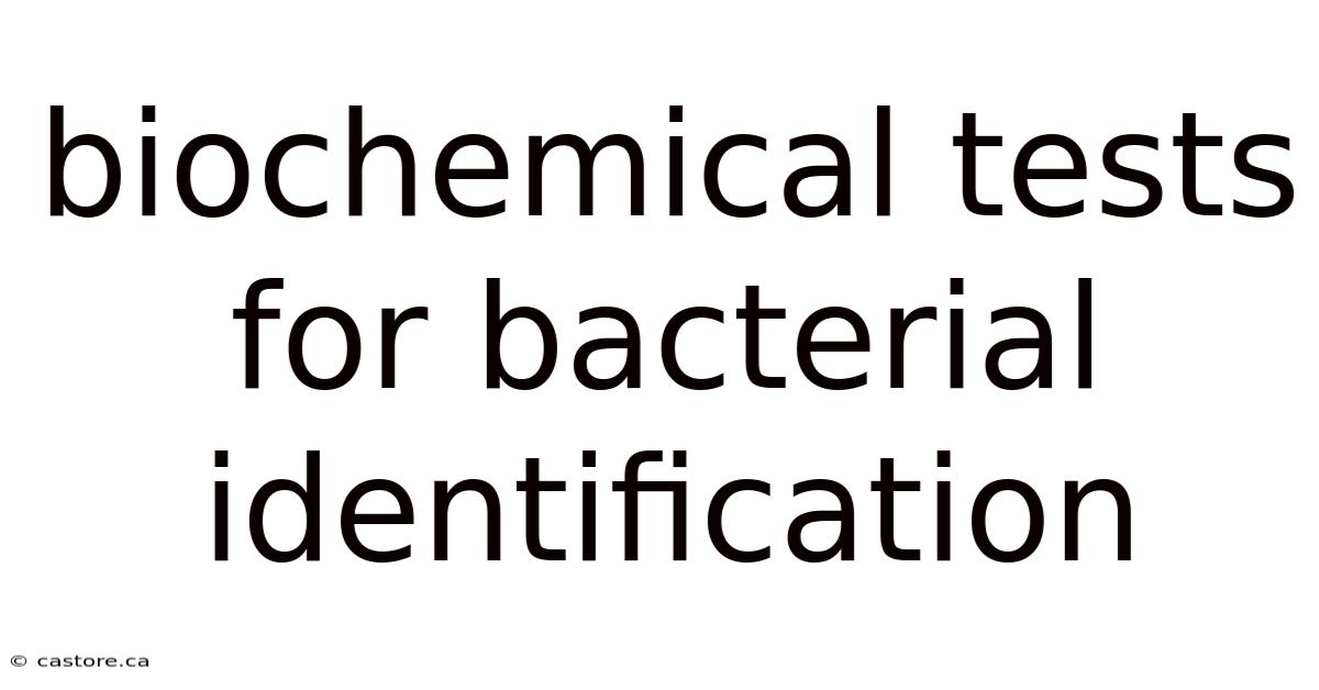 Biochemical Tests For Bacterial Identification