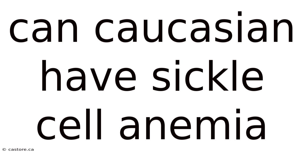 Can Caucasian Have Sickle Cell Anemia