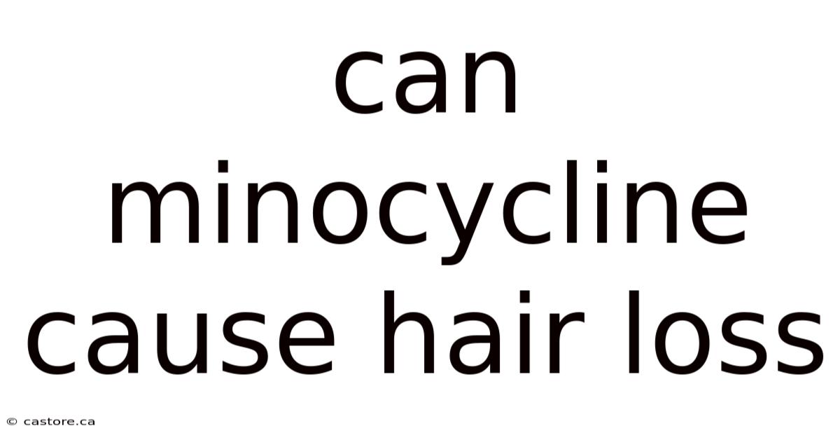 Can Minocycline Cause Hair Loss