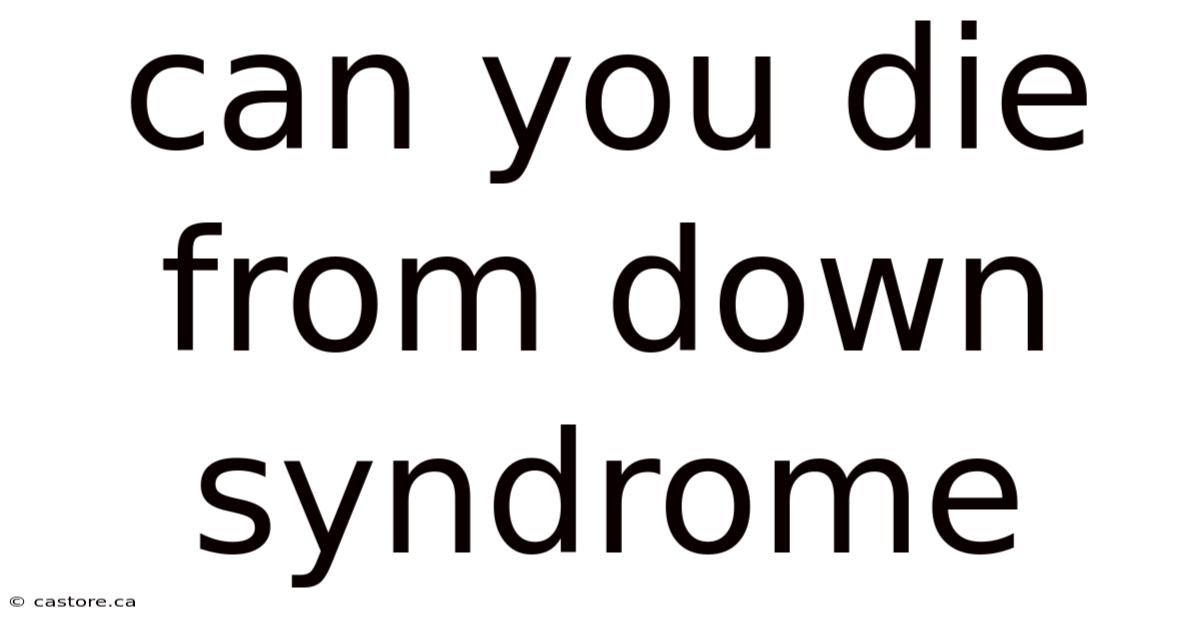 Can You Die From Down Syndrome