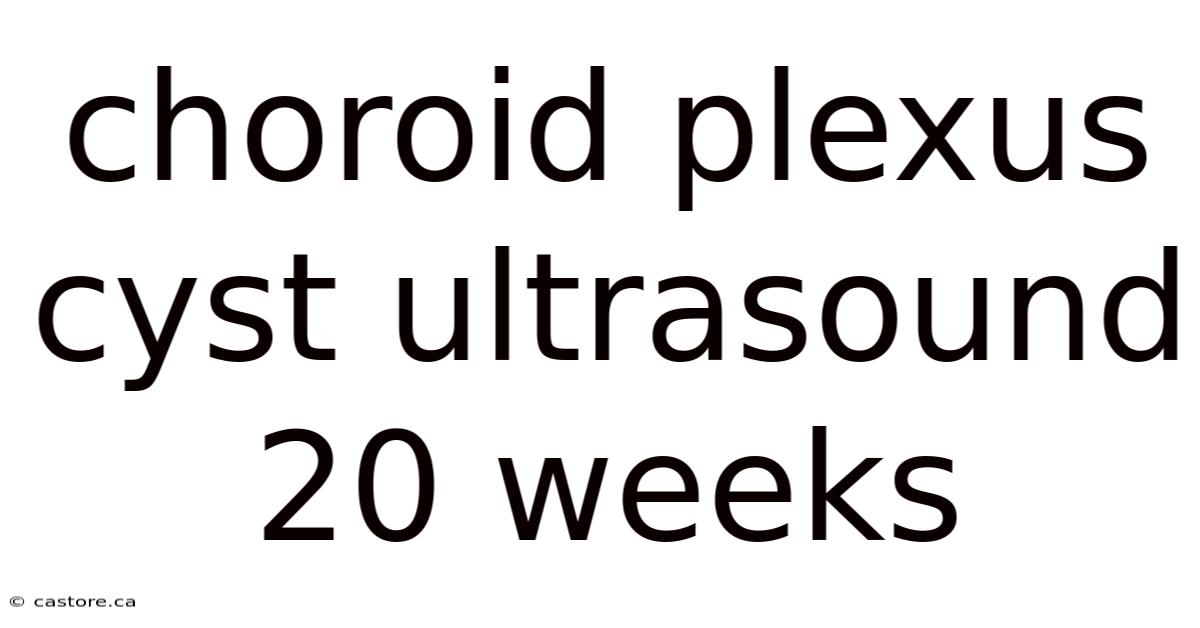 Choroid Plexus Cyst Ultrasound 20 Weeks