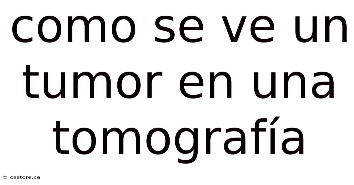 Como Se Ve Un Tumor En Una Tomografía