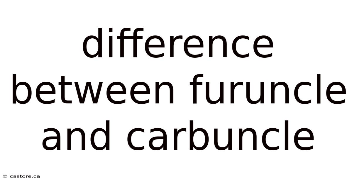 Difference Between Furuncle And Carbuncle