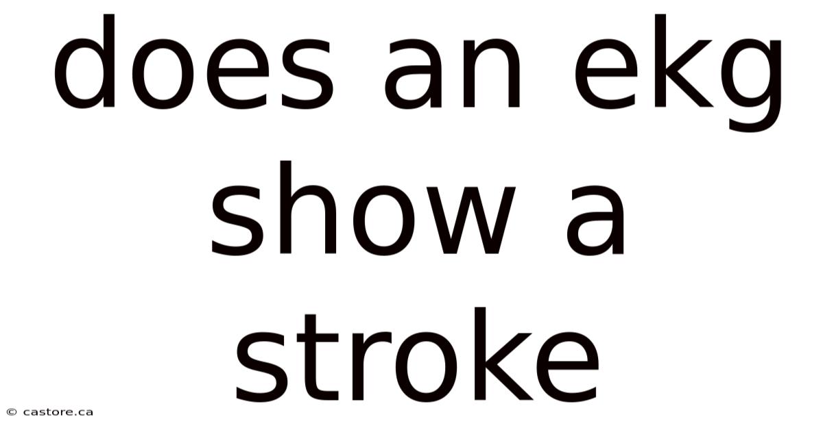 Does An Ekg Show A Stroke