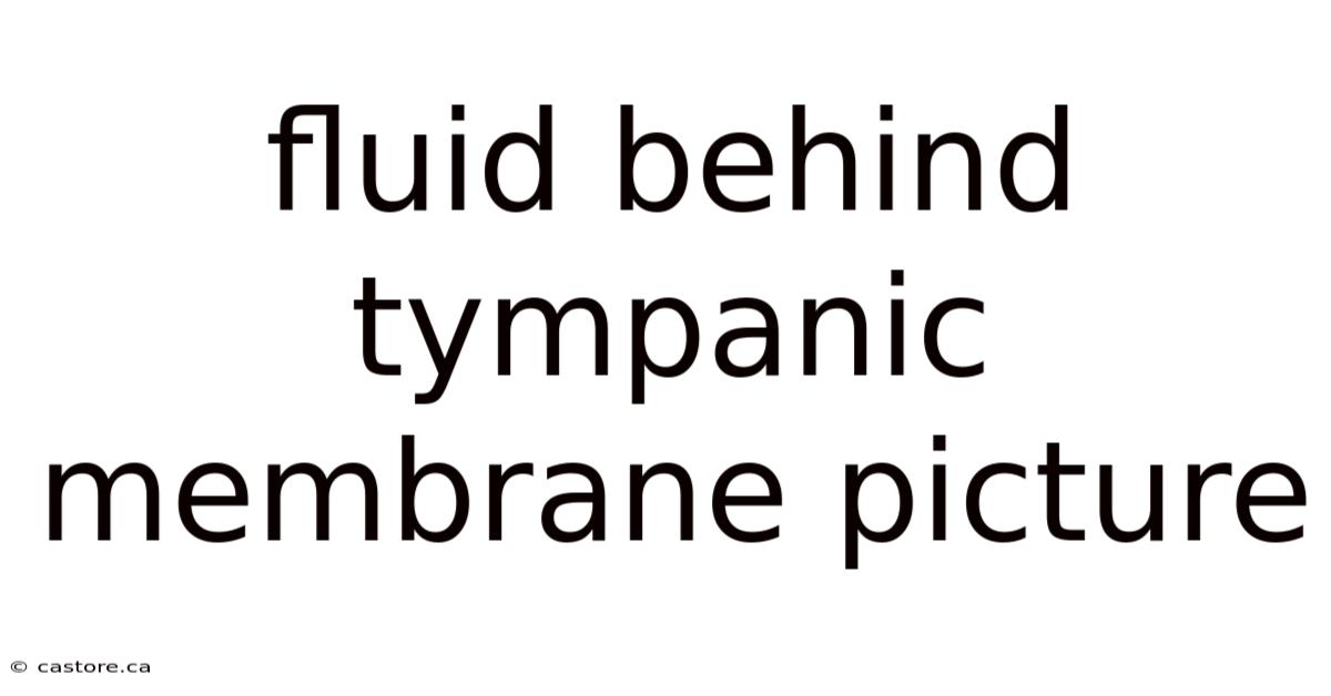 Fluid Behind Tympanic Membrane Picture