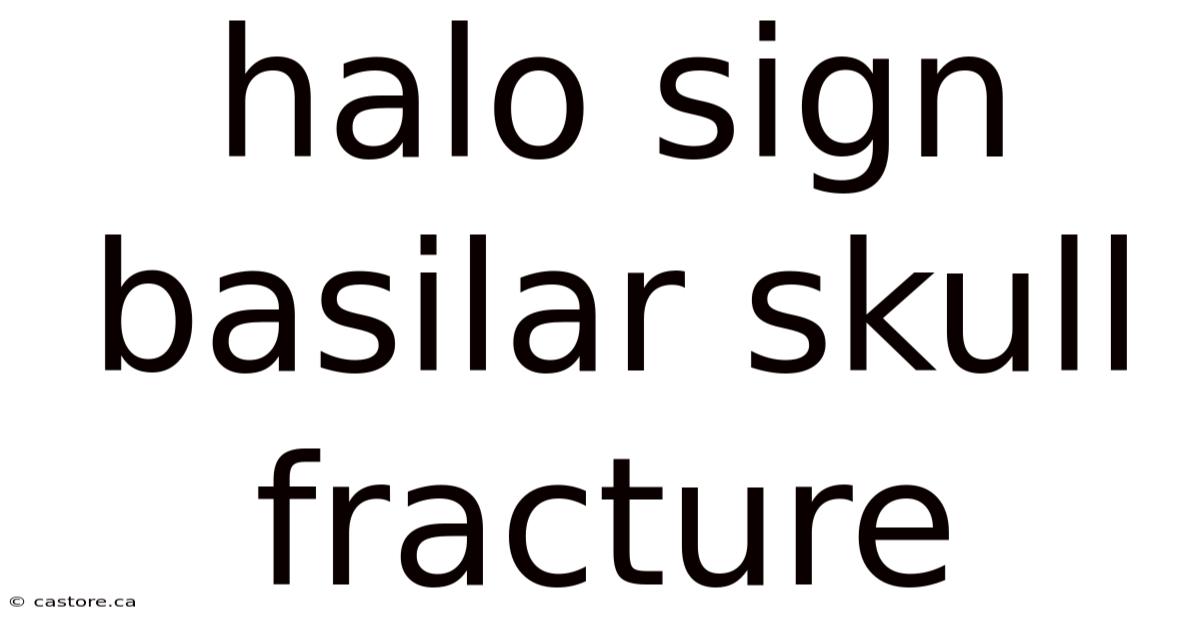 Halo Sign Basilar Skull Fracture