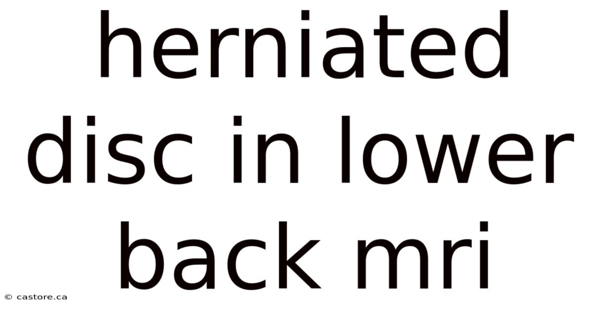 Herniated Disc In Lower Back Mri