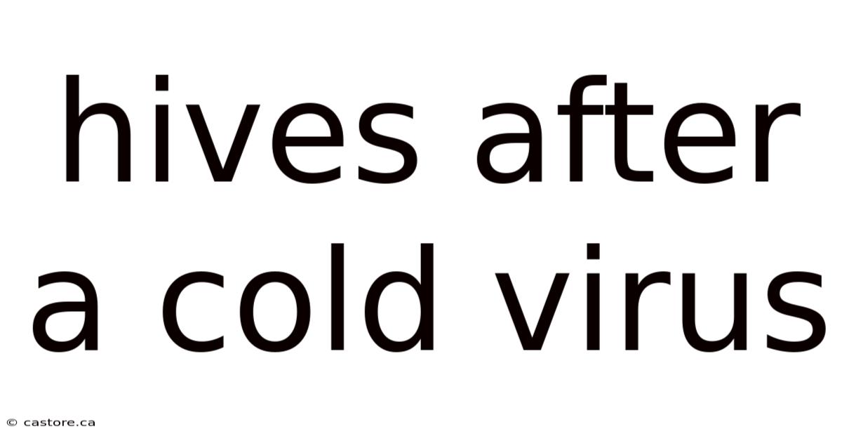 Hives After A Cold Virus