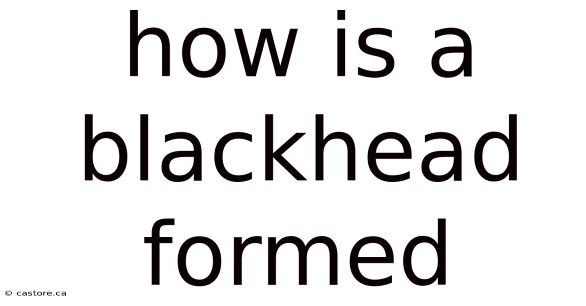How Is A Blackhead Formed