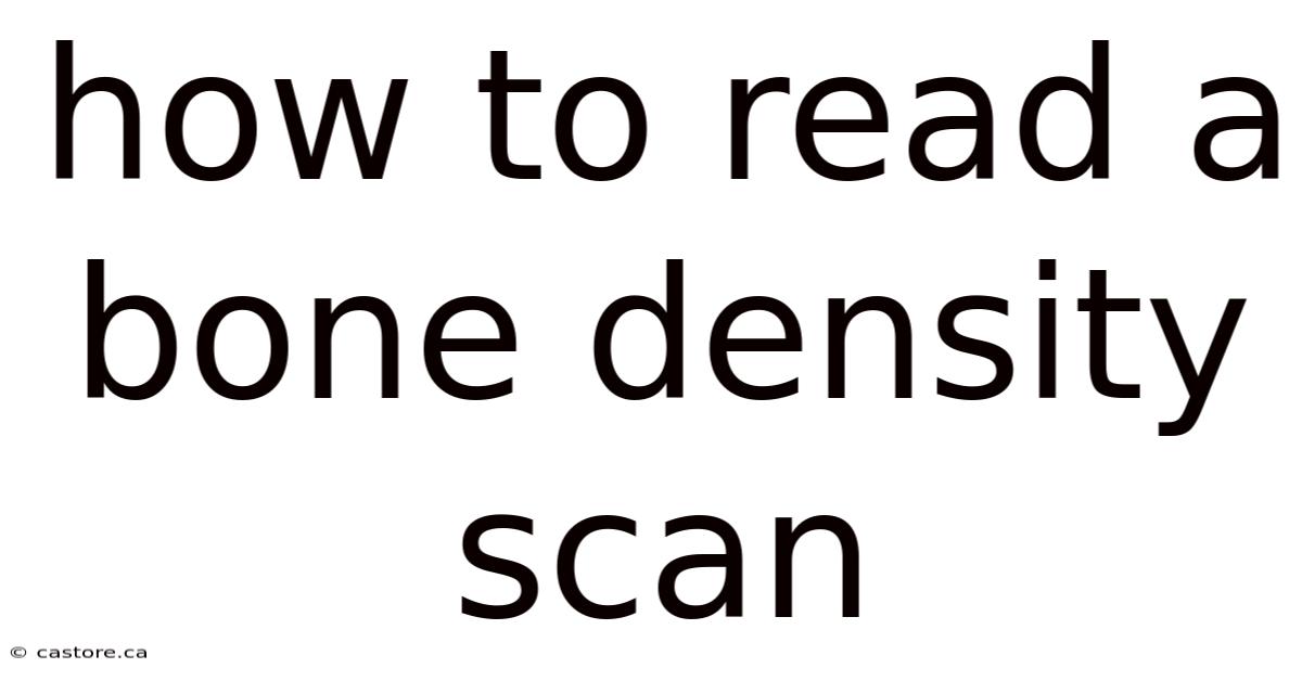 How To Read A Bone Density Scan