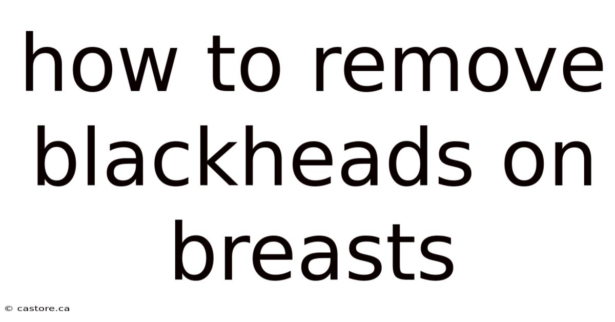 How To Remove Blackheads On Breasts