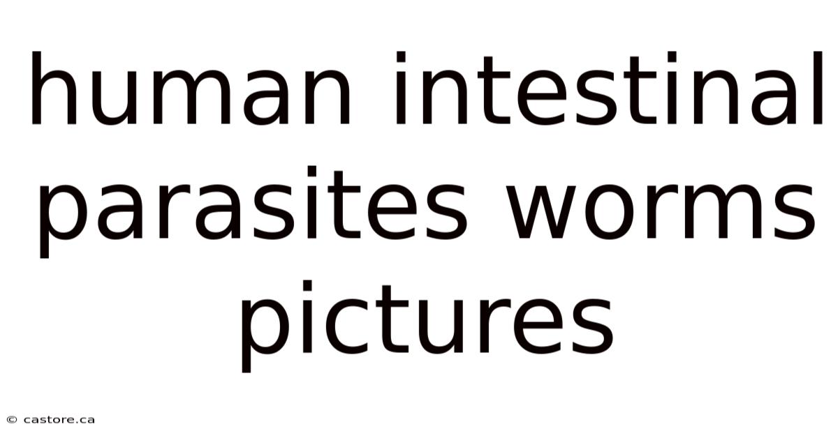 Human Intestinal Parasites Worms Pictures