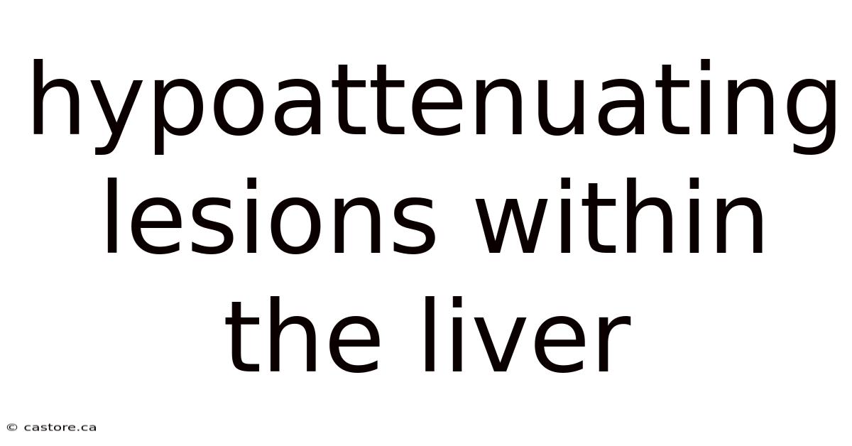 Hypoattenuating Lesions Within The Liver