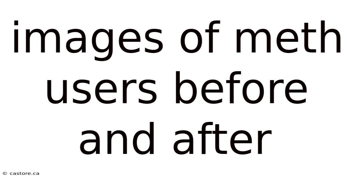 Images Of Meth Users Before And After