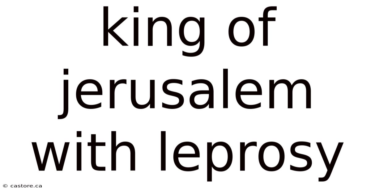 King Of Jerusalem With Leprosy