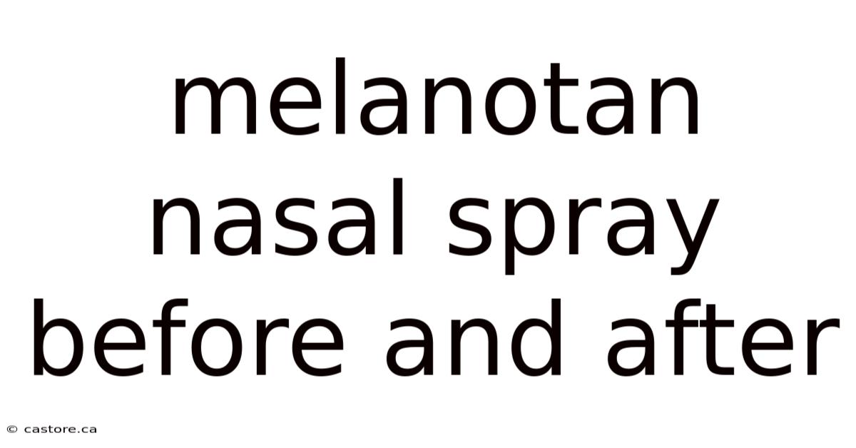 Melanotan Nasal Spray Before And After