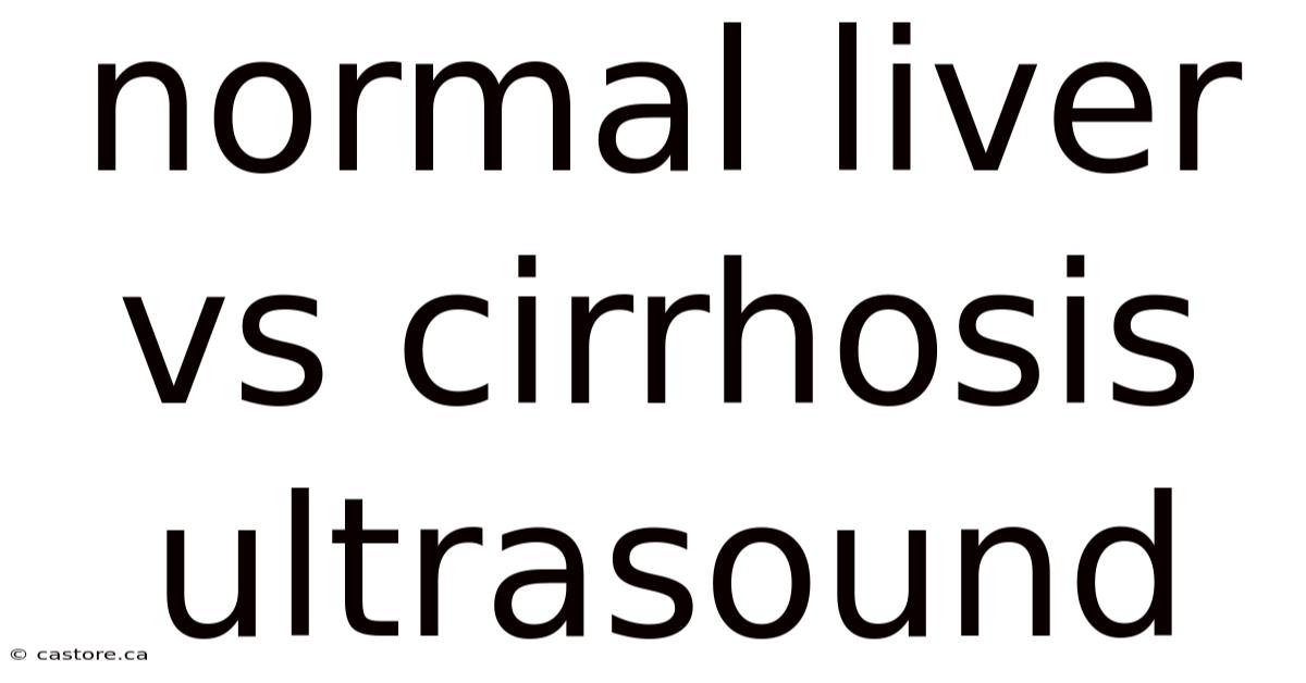 Normal Liver Vs Cirrhosis Ultrasound
