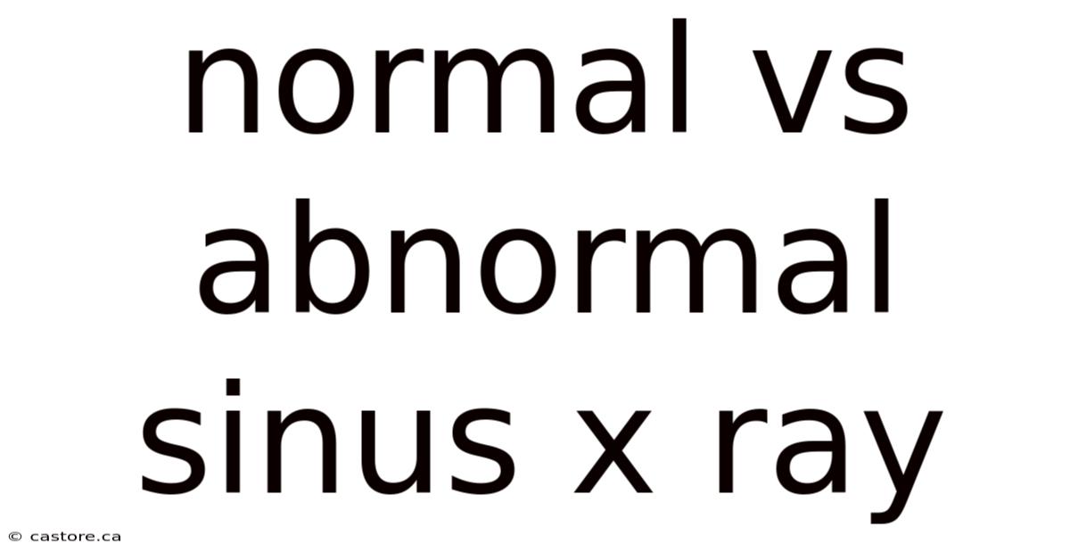 Normal Vs Abnormal Sinus X Ray