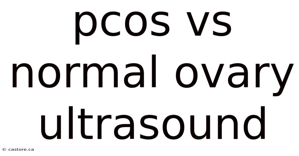 Pcos Vs Normal Ovary Ultrasound