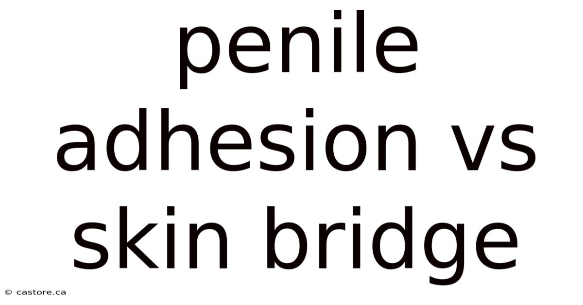 Penile Adhesion Vs Skin Bridge