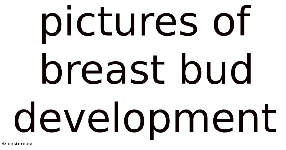 Pictures Of Breast Bud Development