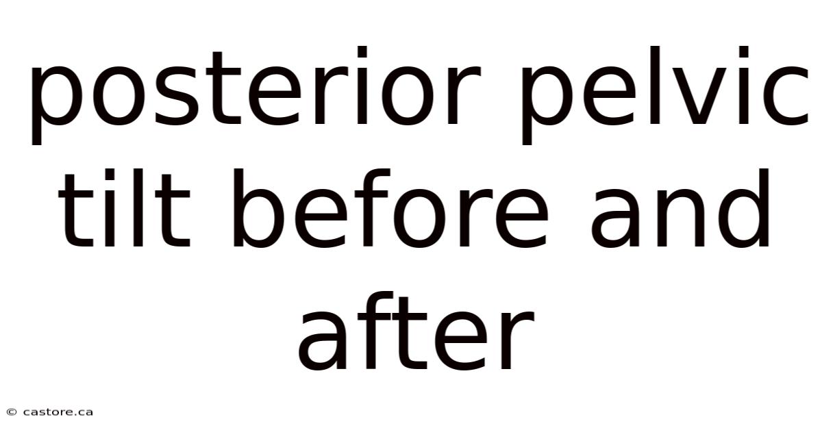 Posterior Pelvic Tilt Before And After