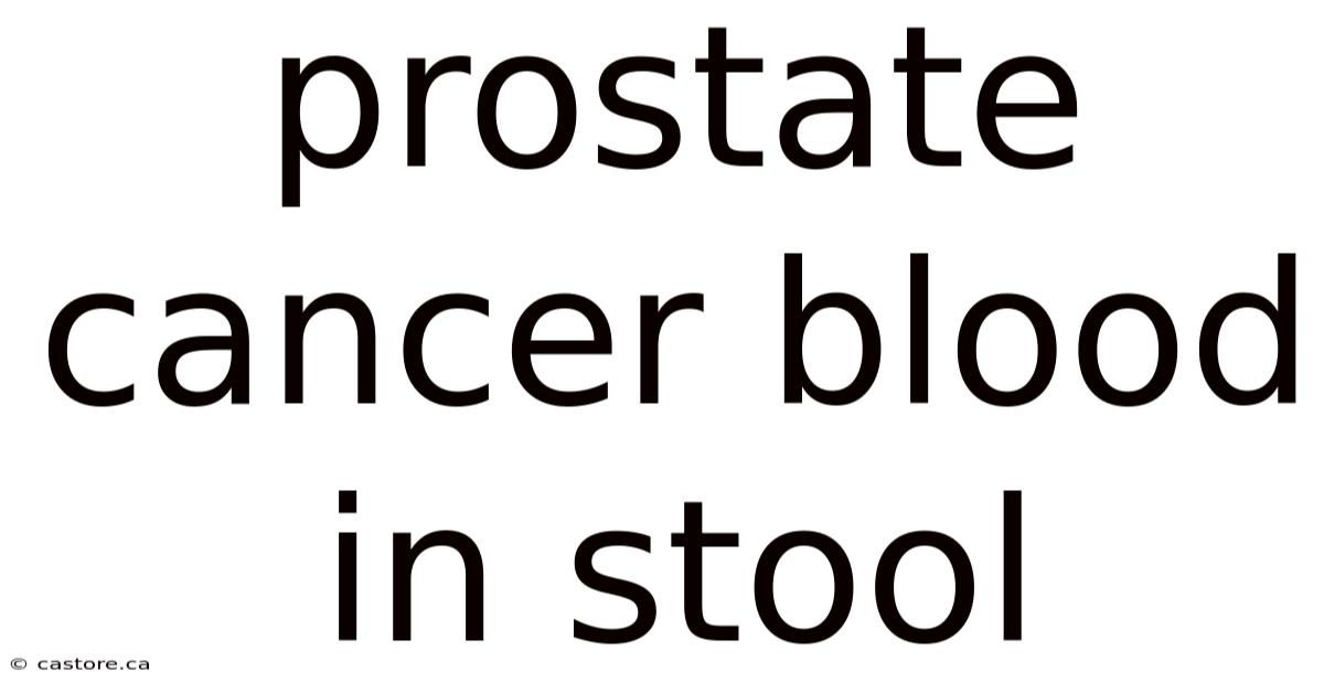 Prostate Cancer Blood In Stool