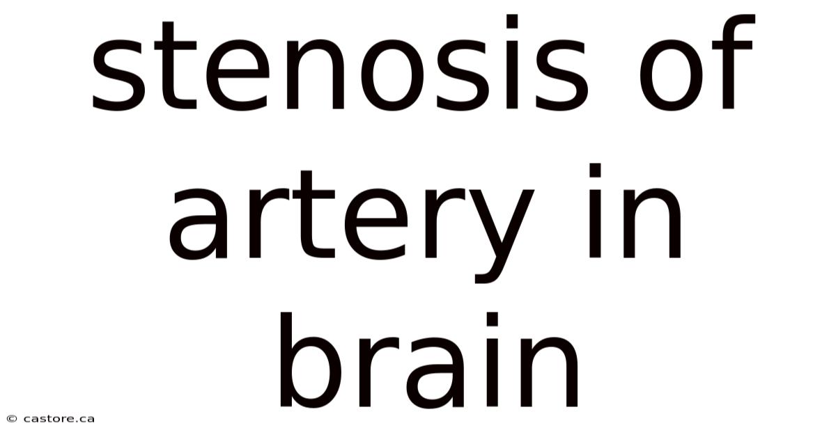 Stenosis Of Artery In Brain