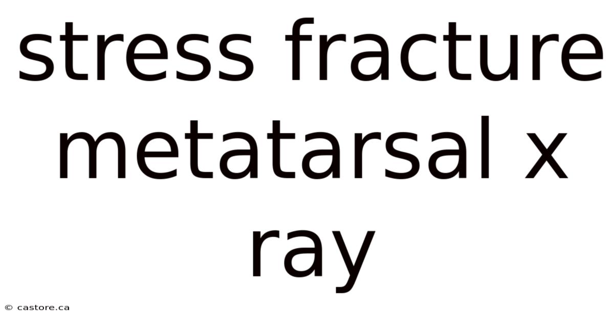 Stress Fracture Metatarsal X Ray