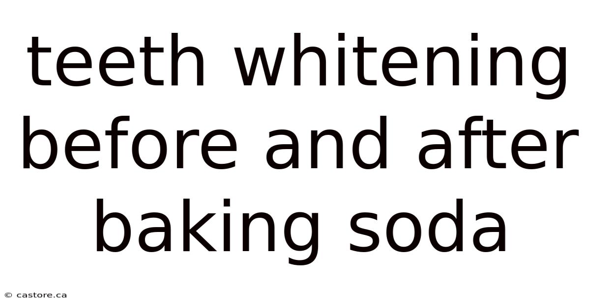 Teeth Whitening Before And After Baking Soda