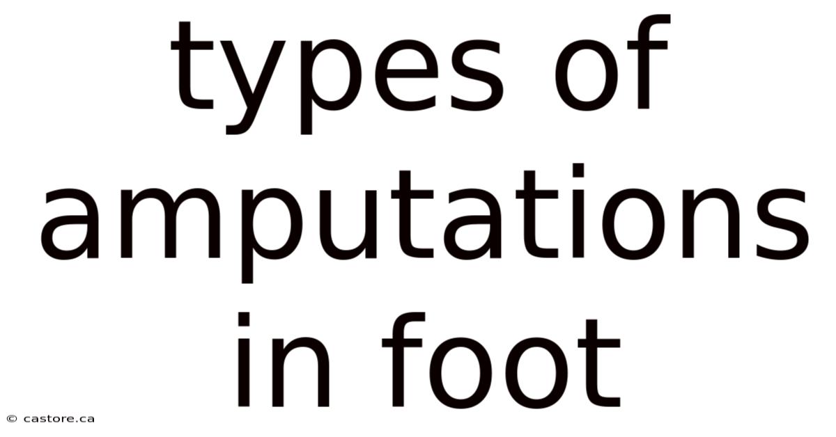 Types Of Amputations In Foot