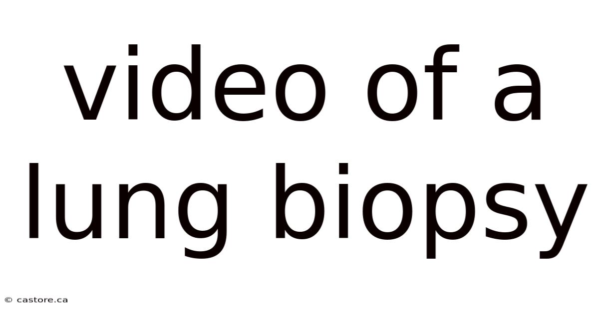 Video Of A Lung Biopsy