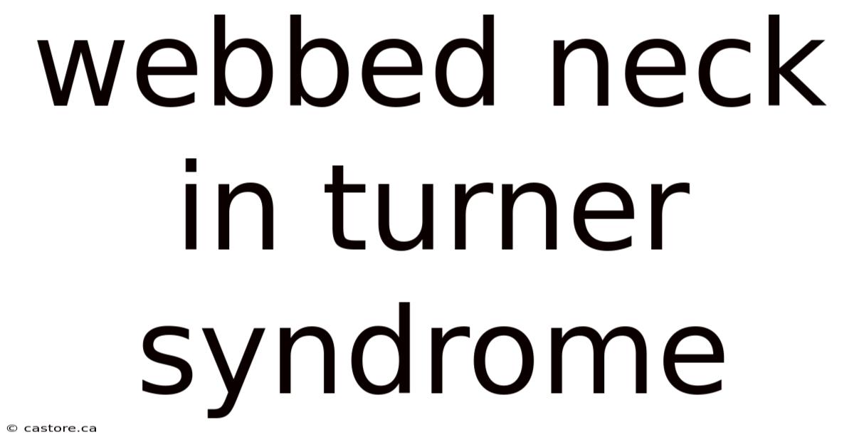 Webbed Neck In Turner Syndrome