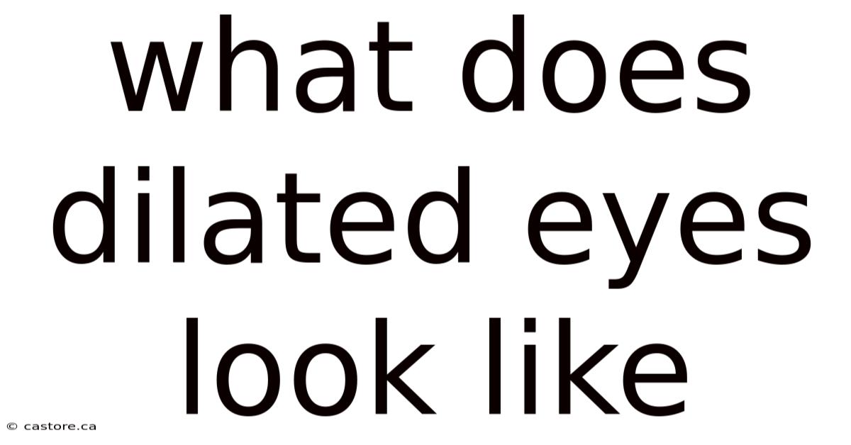 What Does Dilated Eyes Look Like