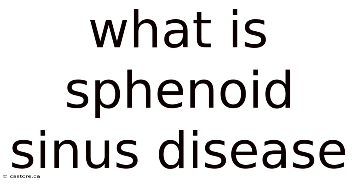 What Is Sphenoid Sinus Disease