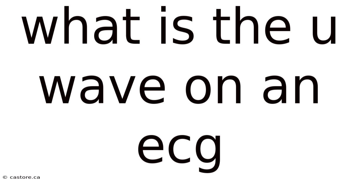 What Is The U Wave On An Ecg