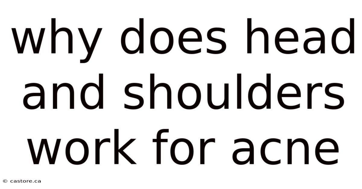 Why Does Head And Shoulders Work For Acne